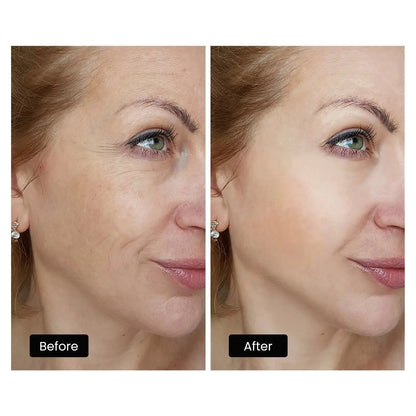 DermRays LED Light Therapy Mask For Face, Neck and Décolletage, Revitalize & Renew Your Skin
