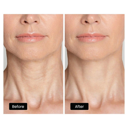 DermRays LED Light Therapy Mask For Face, Neck and Décolletage, Revitalize & Renew Your Skin