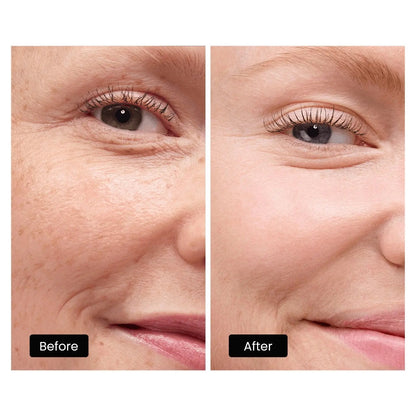 DermRays LED Light Therapy Mask For Face, Neck and Décolletage, Revitalize & Renew Your Skin